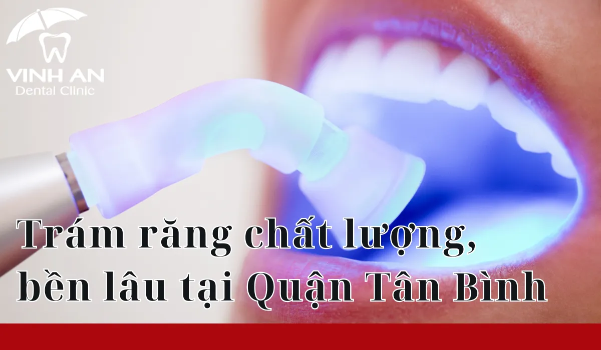 Trám Răng Tân Bình