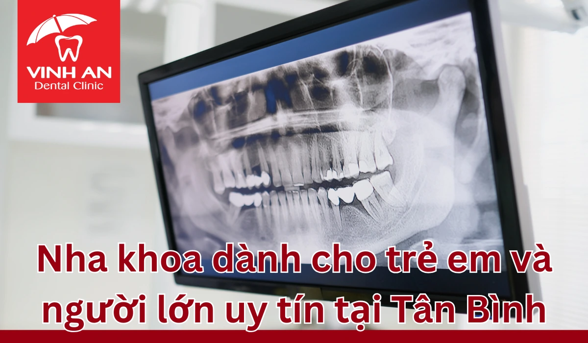 Nha-khoa-cho-tre-em-tan-binh