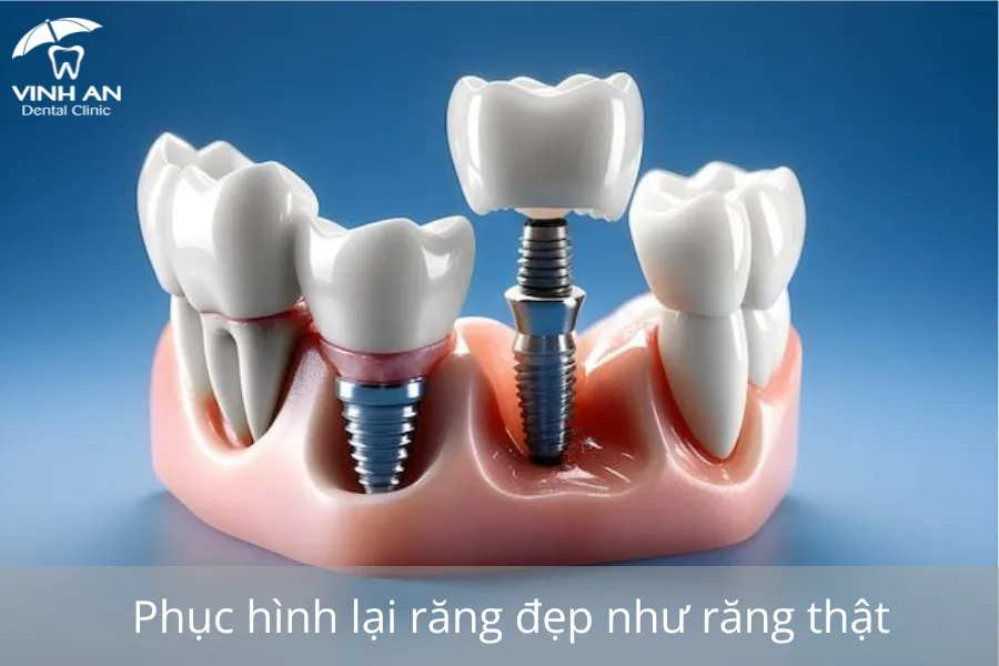Nha-khoa-dieu-tri-tan-binh