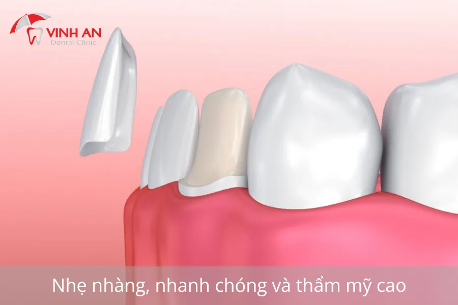 Nha-khoa-dieu-tri-tan-binh