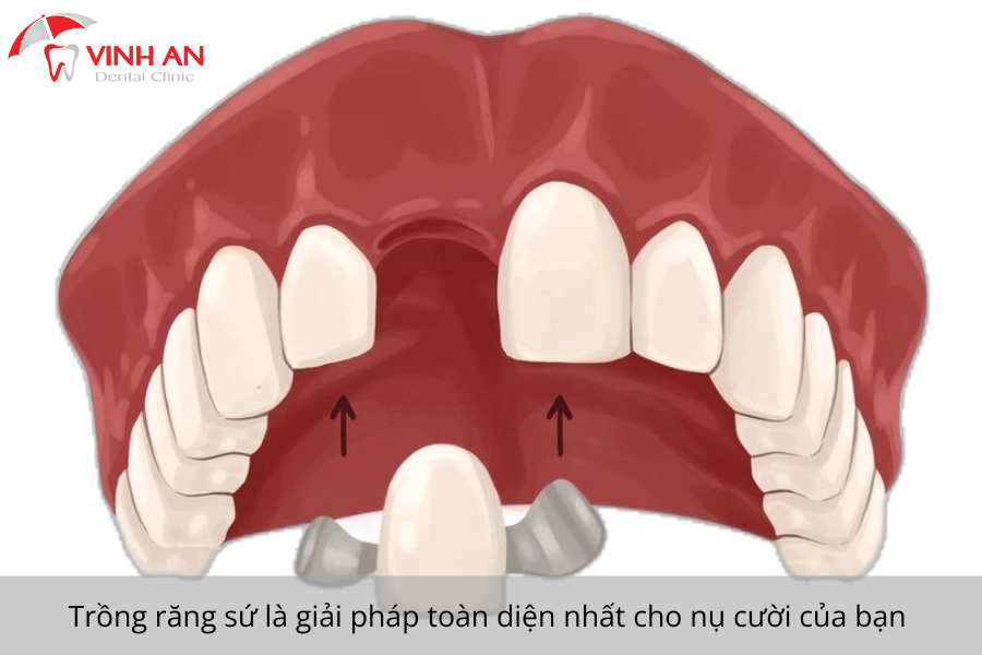 Tham-my-rang-su-tan-binh (2)