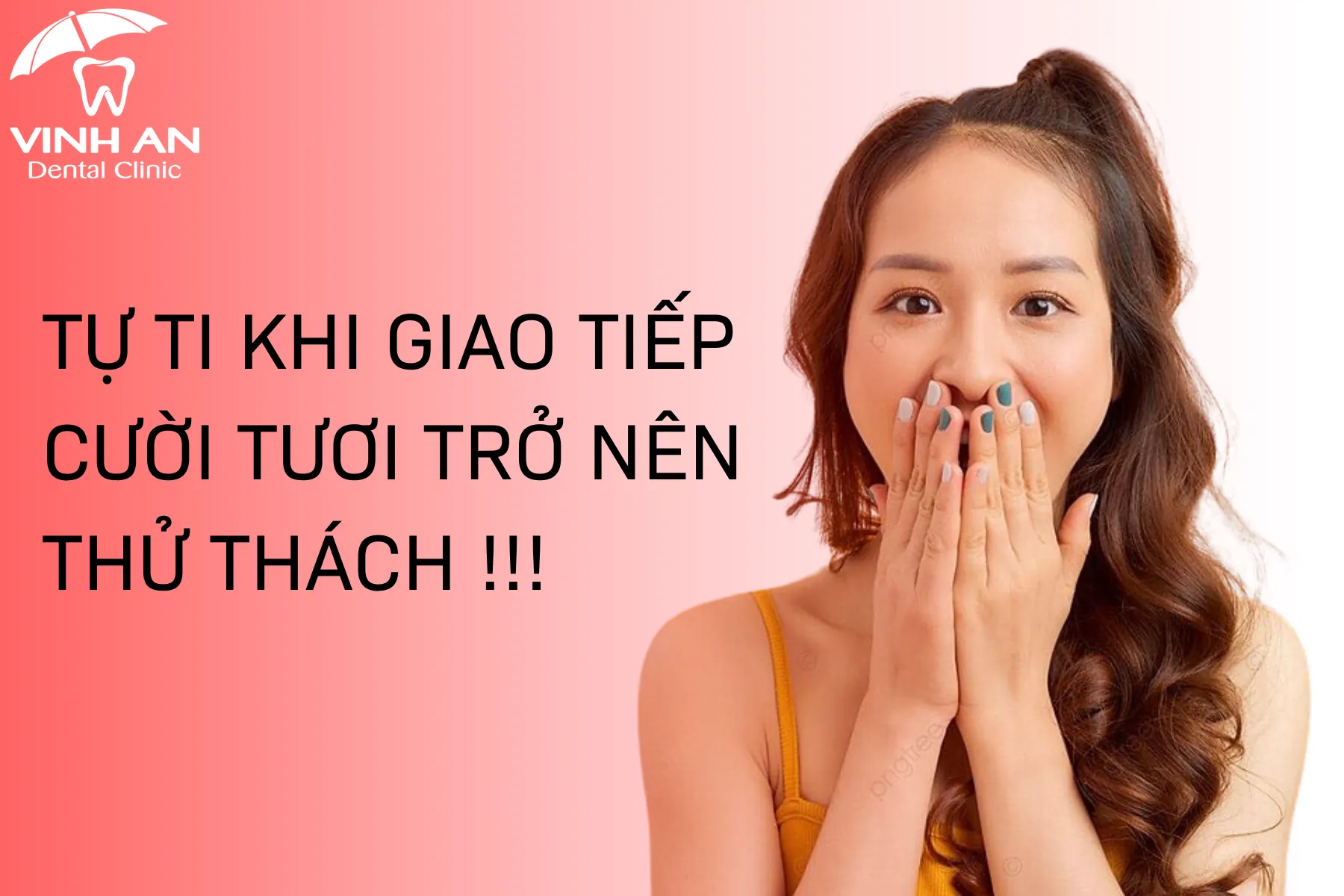 4 Xu hướng điều trị cười hở lợi