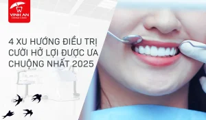 4 xu hướng điều Trị cười hở lợi được ưu chuộng nhất 2025