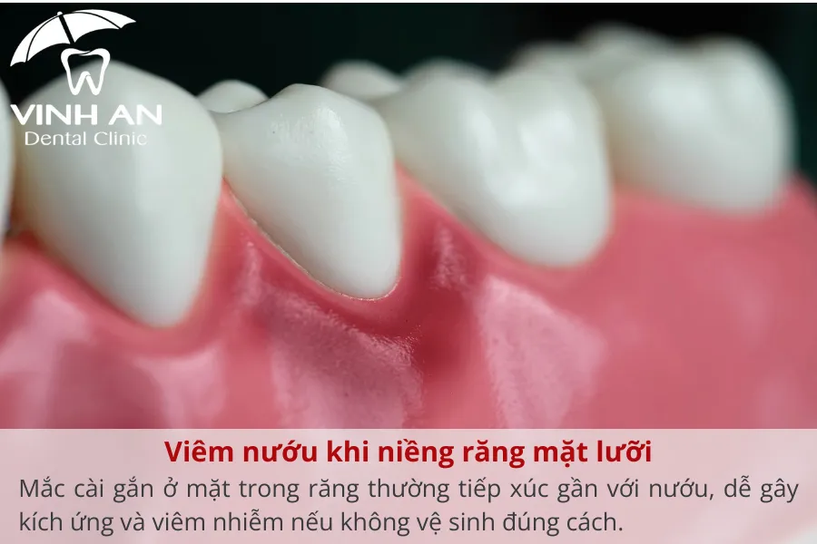 Bien-chung-nieng-rang-mat-luoi (3)