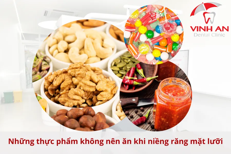 Che-do-an-khi-nieng-rang-mat-luoi (1)