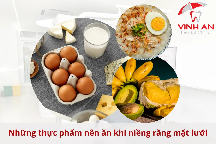 Che-do-an-khi-nieng-rang-mat-luoi (2)