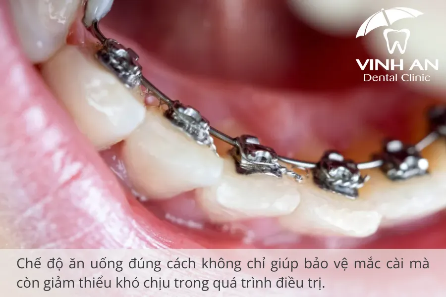 Che-do-an-khi-nieng-rang-mat-luoi (3)