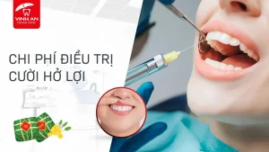 Chi-phi-dieu-tri-cuoi-ho-loi (5)