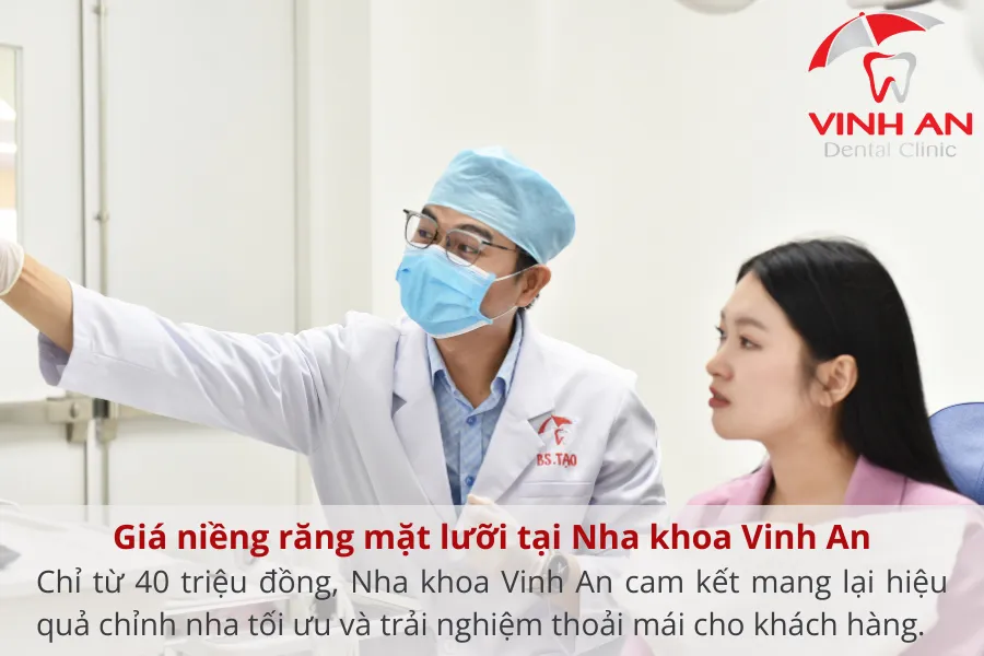 giá niềng răng