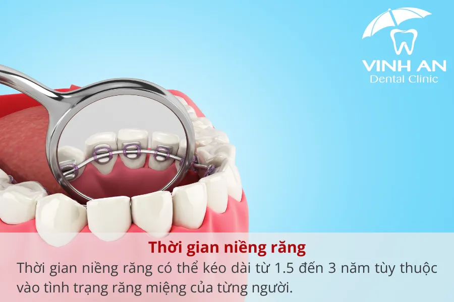 Chi-phi-nieng-rang-mac-cai-mat-luoi (3)