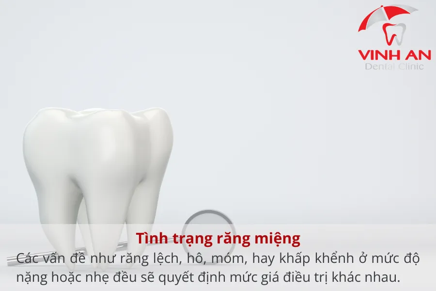 Chi-phi-nieng-rang-mac-cai-mat-luoi (5)