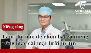 Chon-bac-si-nieng-rang-mat-luoi (5)