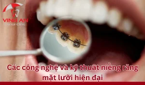 Cong-nghe-nieng-rang-mac-cai-mat-luoi