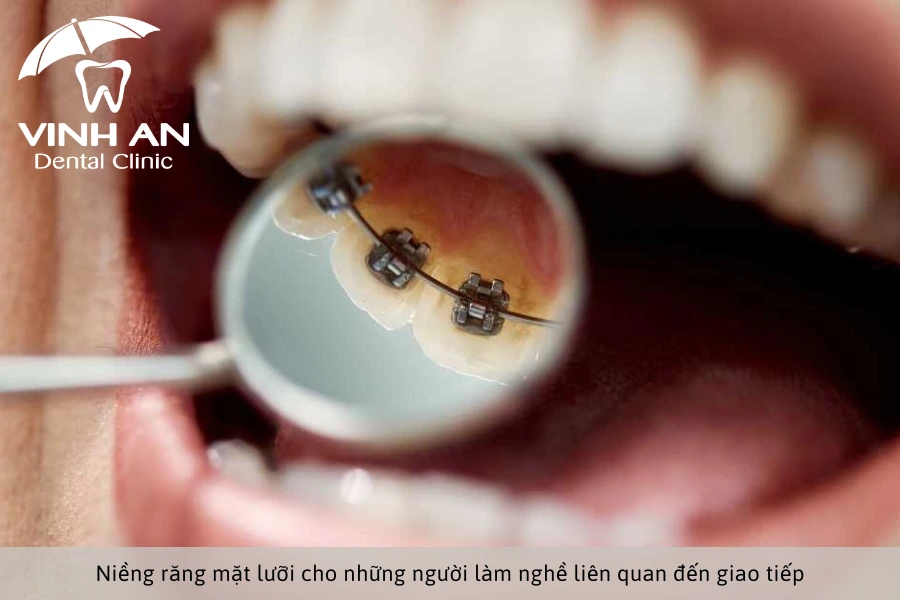 Doi-tuong-nieng-rang-mat-luoi (2)