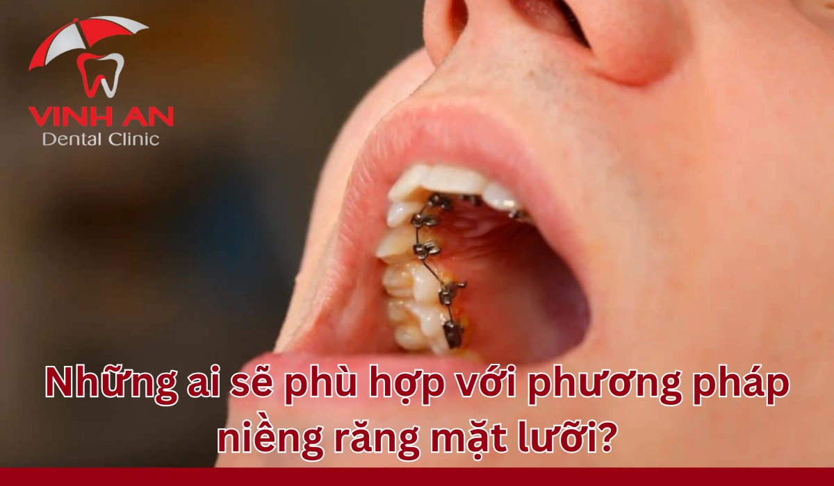 Doi-tuong-nieng-rang-mat-luoi (5)