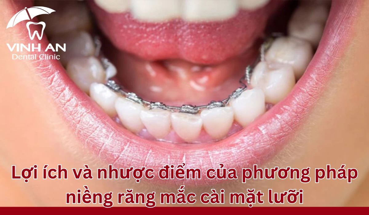 Loi-ich-nieng-rang-mac-cai-mat-luoi (1)