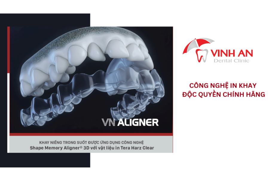VN Aligner