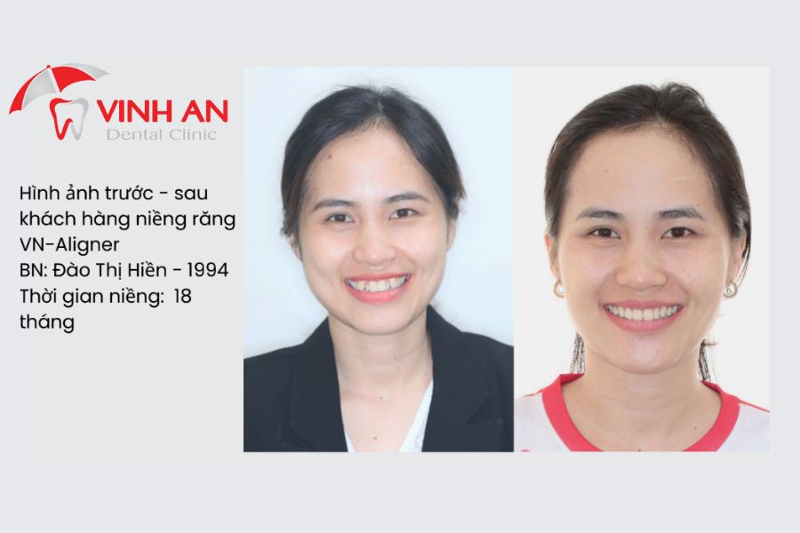 hình ảnh khách hàng