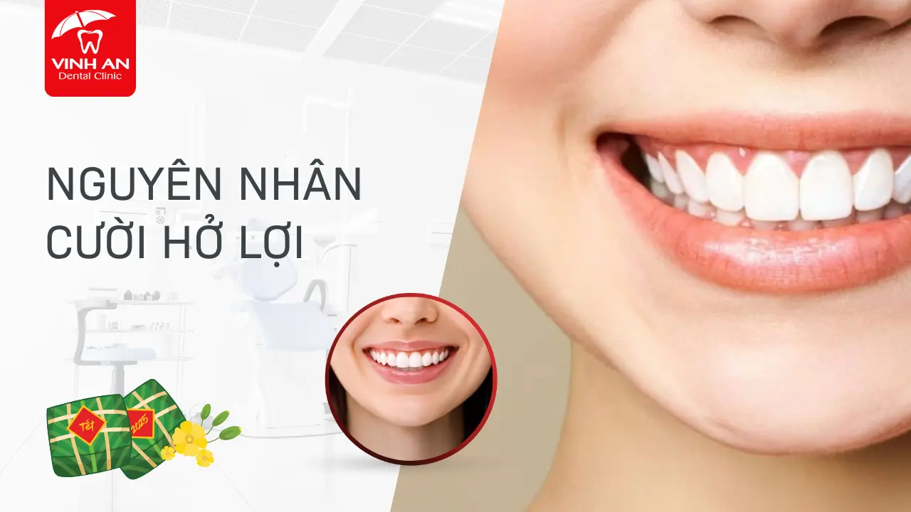 Nguyen-nhan-cuoi-ho-loi