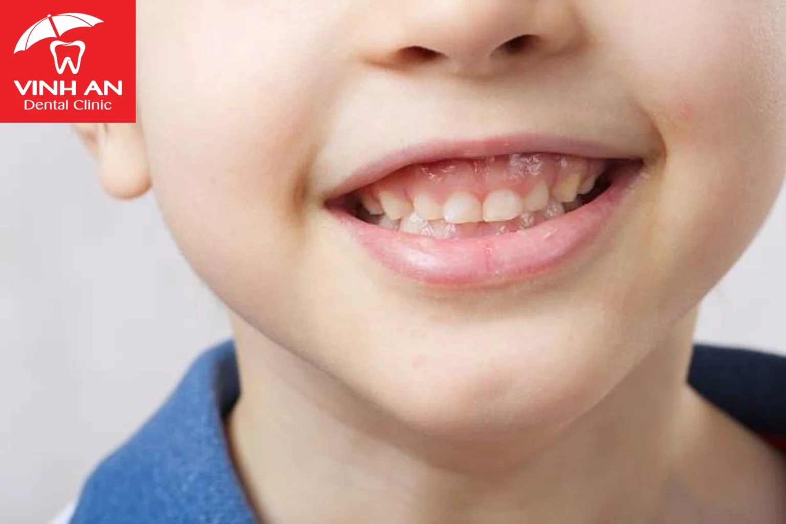 Nguyen-nhan-cuoi-ho-loi (9)