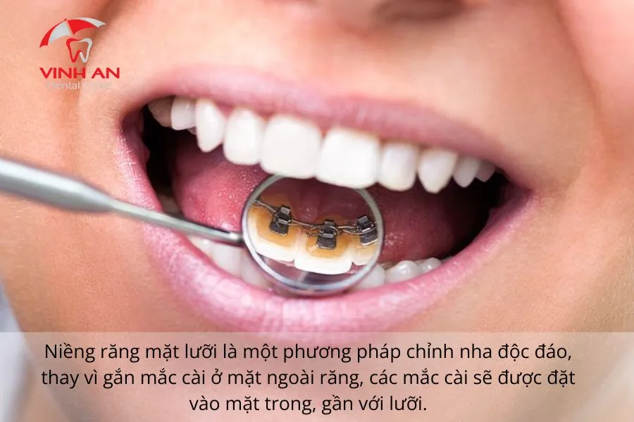 Nieng-rang-mac-cai-mat-luoi (1)