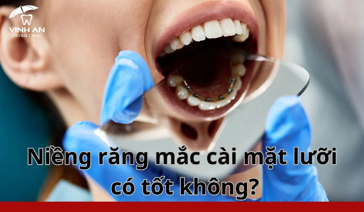 Nieng-rang-mac-cai-mat-luoi (6)