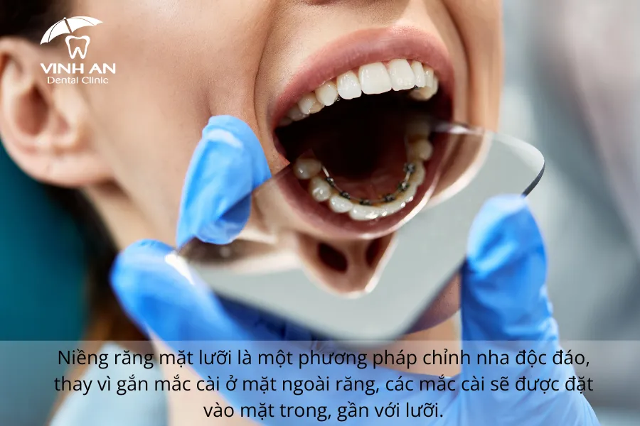 Nieng-rang-mac-cai-mat-luoi-co-dau-khong (1)