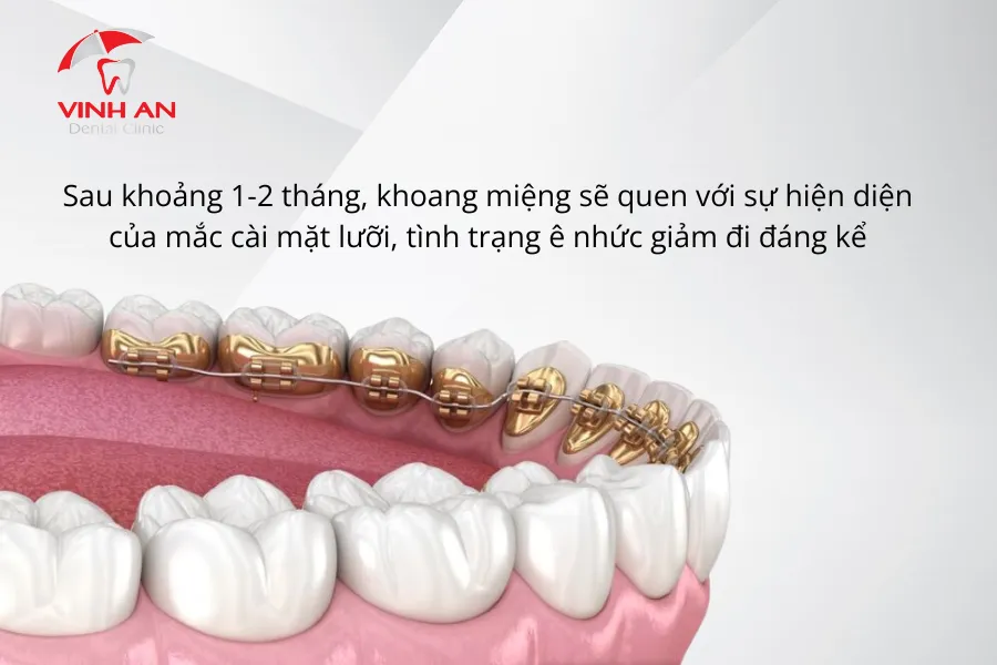 Nieng-rang-mac-cai-mat-luoi-co-dau-khong (5)
