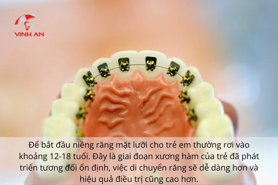 Nieng-rang-mat-luoi-cho-tre-em (4)