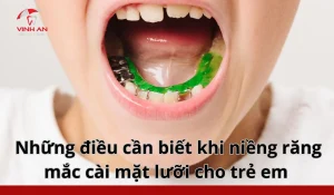 Nieng-rang-mat-luoi-cho-tre-em (7)