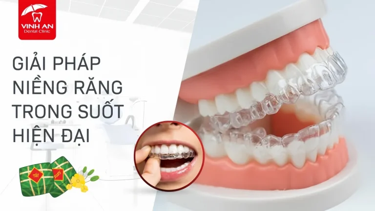 Nieng-rang-trong-suot-la-gi