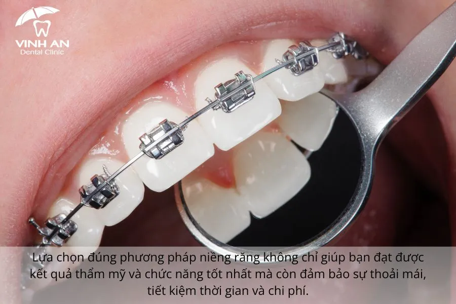 So-sanh-nieng-rang-mac-cai-mat-luoi (1)