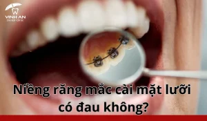 Thoi-gian-nieng-rang-mat-luoi (1)