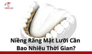 niềng răng mắc cài mặt lưỡi tốn bao nhiêu thời gian