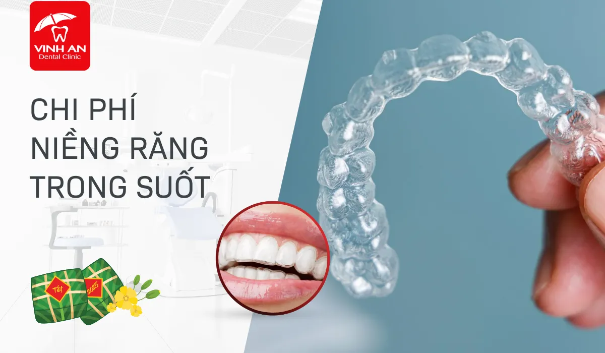 Thumbnail-chi-phi-nieng-rang-trong-suot