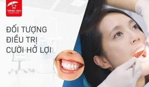 Doi-tuong-dieu-tri-cuoi-ho-loi