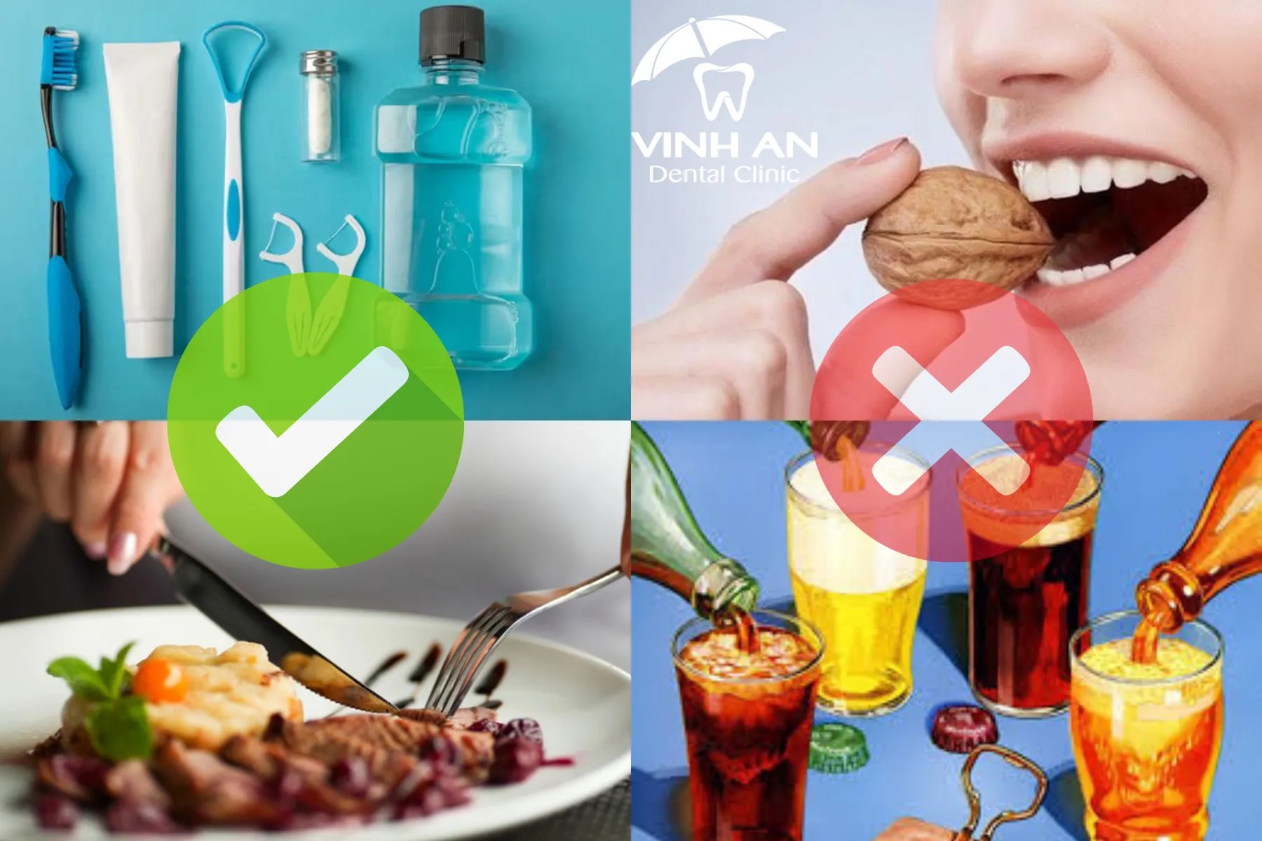 Câu Hỏi Thường Gặp Về Niềng Răng
