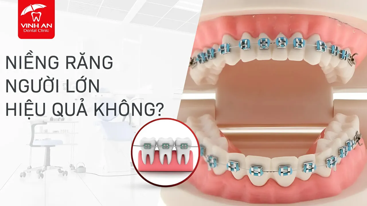 Nieng-rang-nguoi-lon