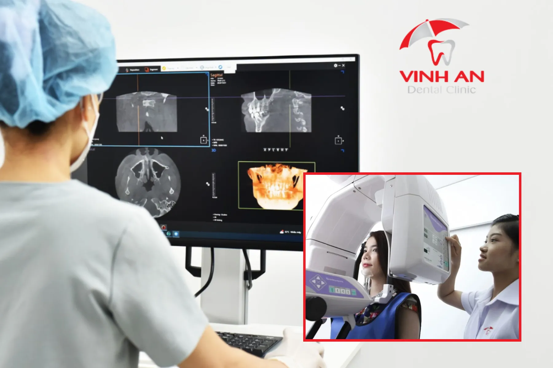 Nieng-rang-o-dau-tot