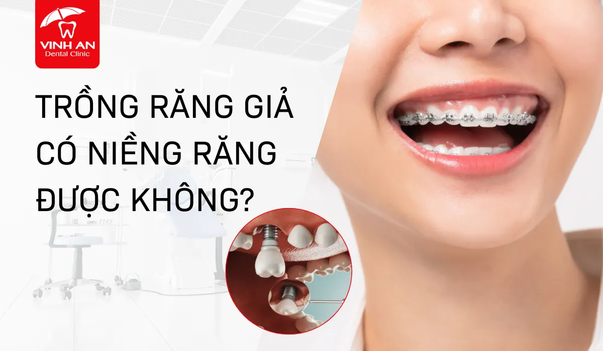 Trồng răng giả niềng răng được không