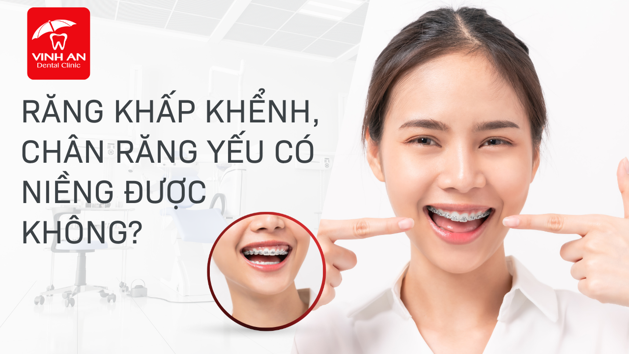 Rang-khap-khenh-chan-rang-yeu-co-nieng-duoc-khong