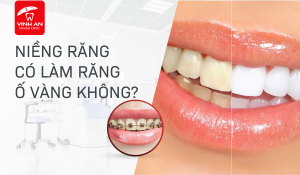 Thumbnail-nieng-rang-co-lam-o-rang-khong