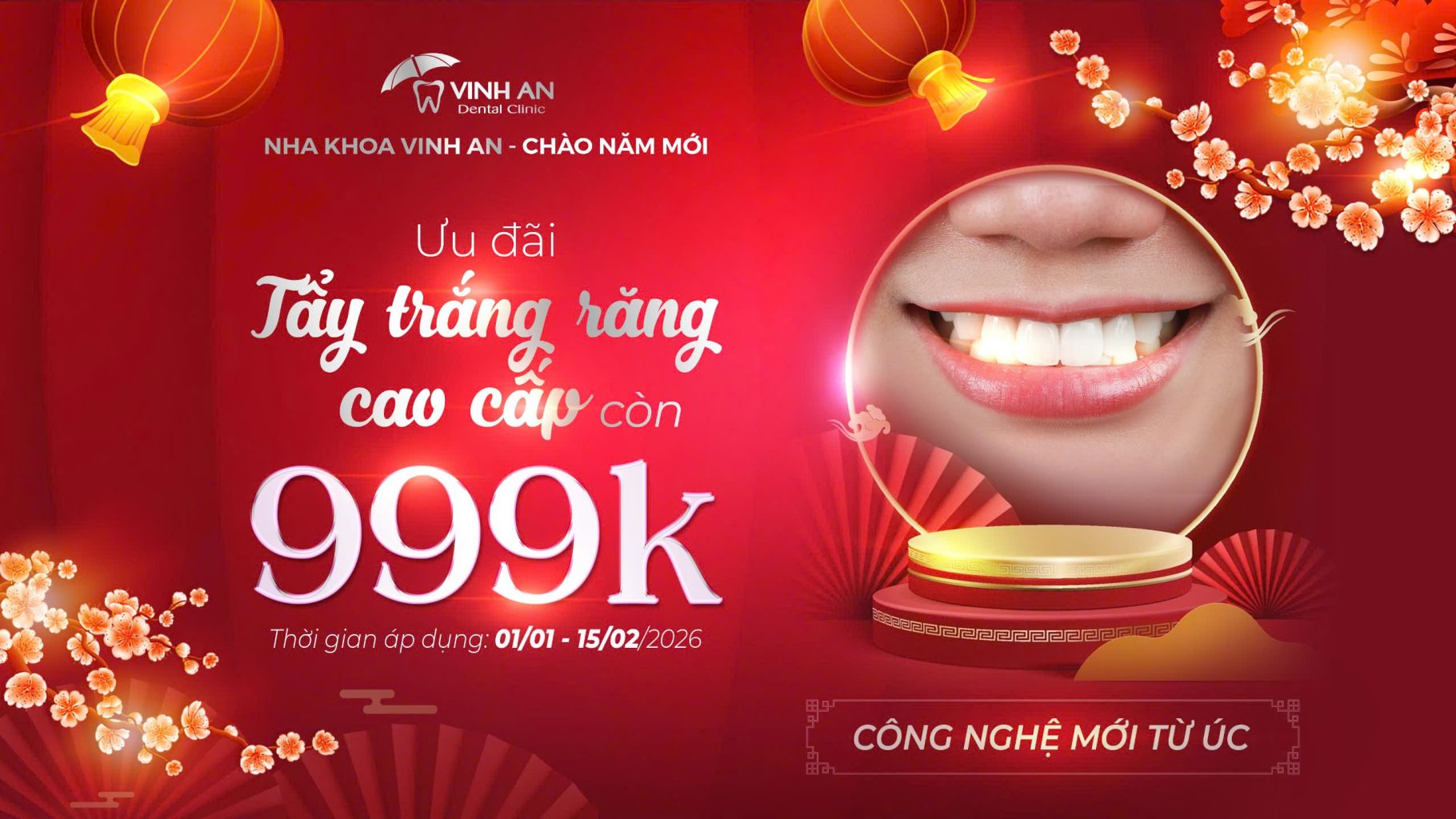 Ưu Đãi Tẩy Trắng Răng - 999K