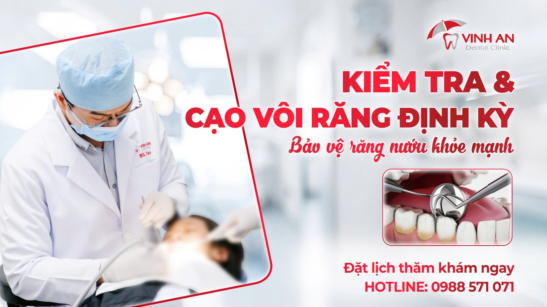 Kiểm tra và cạo vôi răng định kỳ