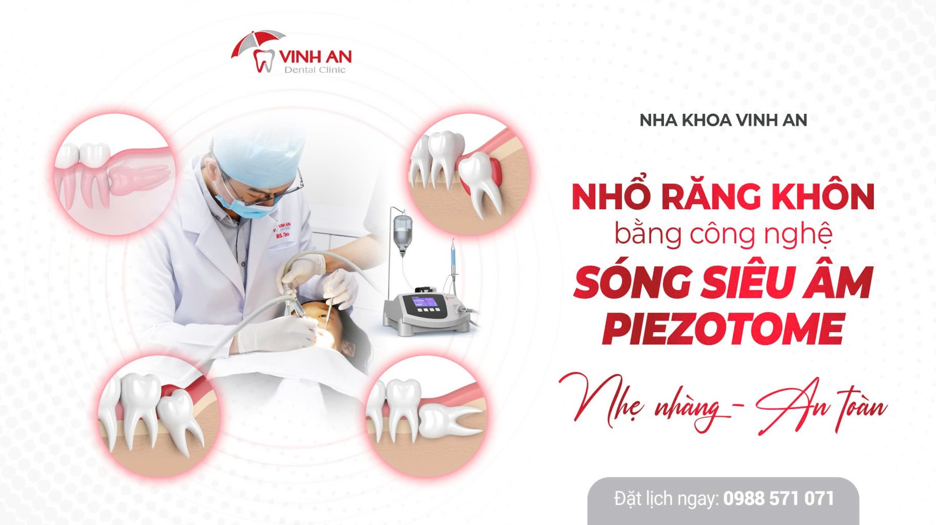 XỬ LÝ RĂNG KHÔN MỌC LỆCH, MỌC NGANG CHỈ 30 PHÚT VỚI SÓNG SIÊU ÂM