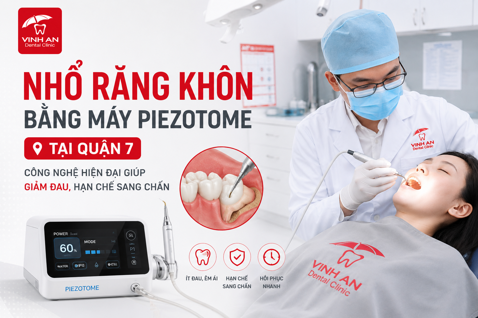 Nhổ Răng Khôn Bằng Máy Piezotome