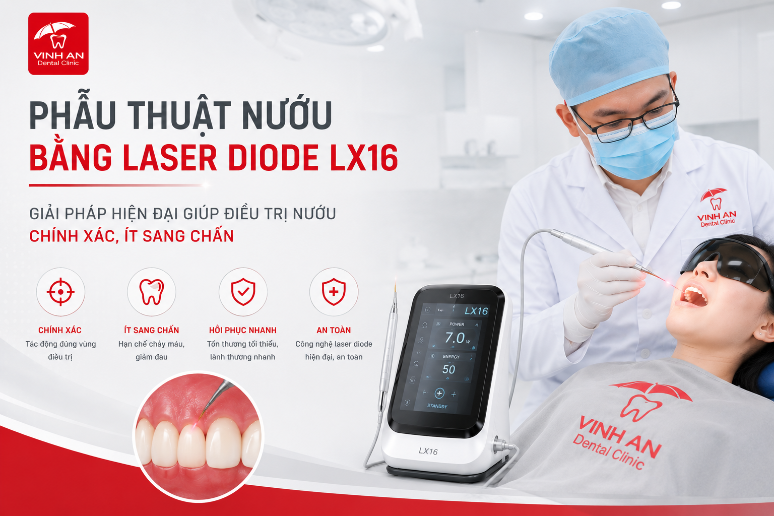 Phẫu Thuật Nướu Bằng Laser Diode LX16