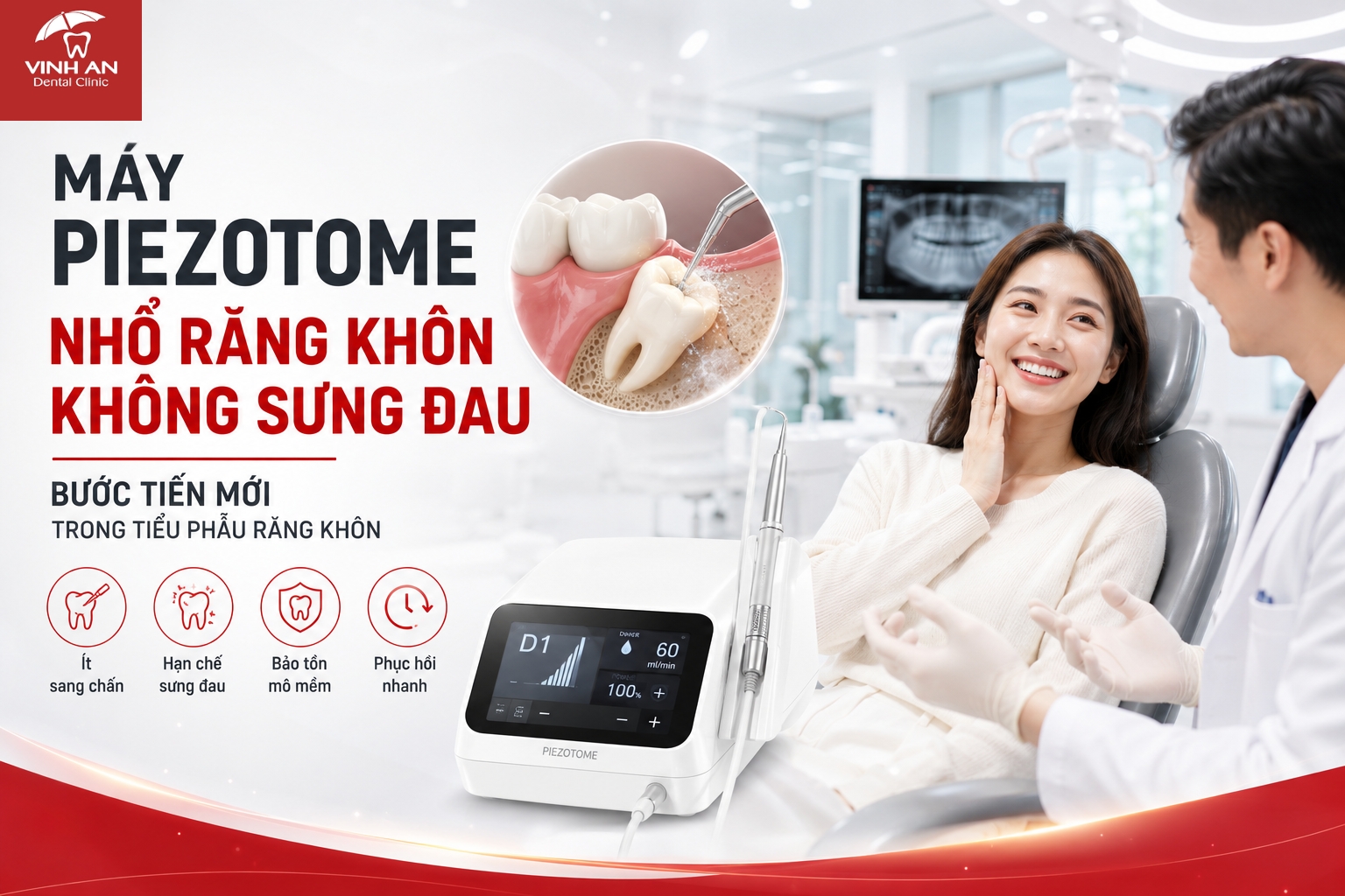 Máy Piezotome Nhổ Răng Khôn Không Sưng Đau