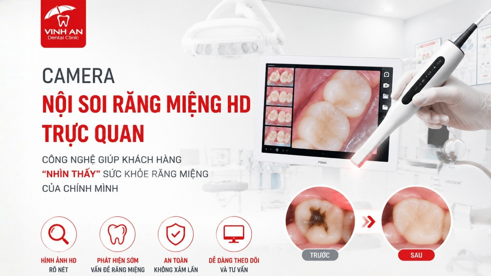 Camera Nội Soi Răng Miệng HD Trực Quan