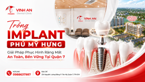 Trồng Implant Phú Mỹ Hưng – Giải Pháp Phục Hình Răng Mất An Toàn, Bền Vững Tại Quận 7